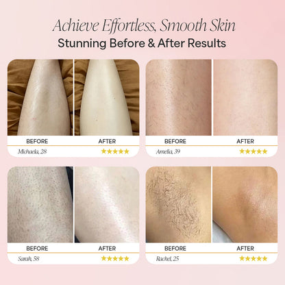 Dovior 2-in-1 Women's Body Shaver